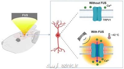 درمان اختلالات عصبی به روش غیرتهاجمی