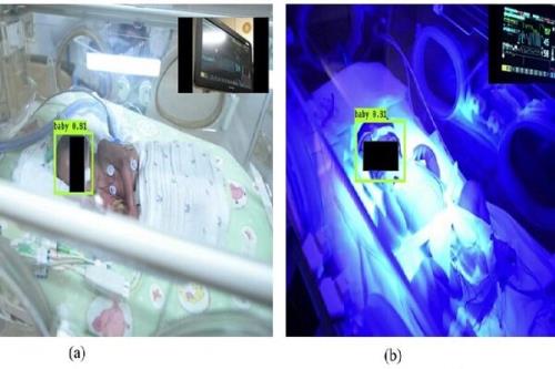 استفاده از هوش مصنوعی برای شناسایی و کنترل نوزادان نارس