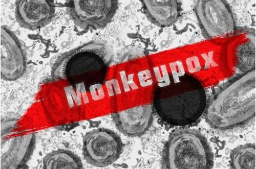 اعلام وضعیت اضطراری شیوع آبله میمونی در آمریکا