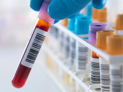 یک آزمایش خون با قابلیت تشخیص ده ها نوع سرطان