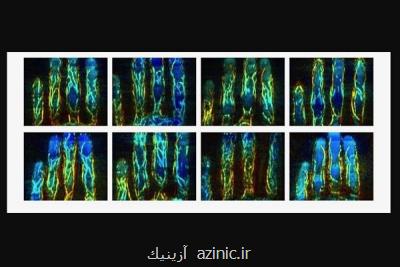 تهیه اثرانگشت غیرقابل جعل با اسكن سیاهرگ ها